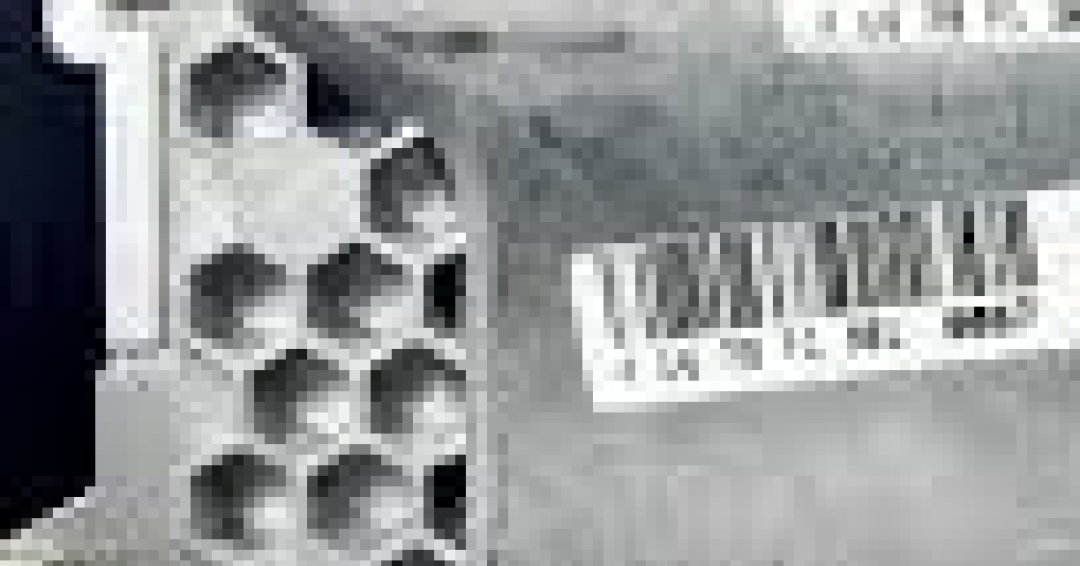 شناسایی انواع ایسیو ssat شناسایی انواع ایسیو ssat